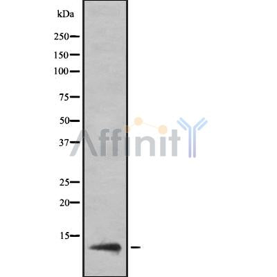 Western blot analysis of extracts from VERO, using KKLC1 Antibody. The lane on the left was treated with blocking peptide.

Observed bands: 20 kDa.
