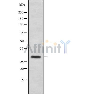 Western blot analysis of extracts from COS7, using CT47A Antibody. The lane on the left was treated with blocking peptide.