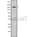 Western blot analysis of TENS3 using K562 whole cell lysates