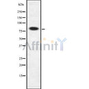Western blot analysis F111B using RAW264.7 whole cell lysates