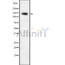 Western blot analysis of LMTK1 using COLO205 whole cell lysates