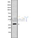 Western blot analysis of MOB2 using LOVO whole cell lysates
