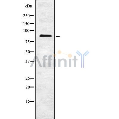 Western blot analysis of extracts from Mouse spleen, using FAKD5 Antibody. The lane on the left was treated with blocking peptide.