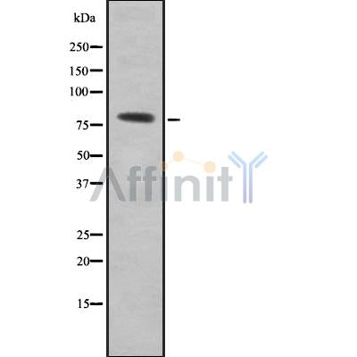 Western blot analysis SDCCAG8 using COLO205 whole cell lysates