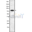 Western blot analysis of BRSK2 using HuvEc whole cell lysates