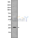 Western blot analysis of extracts from Rat lung, using TNFAIP8L1 Antibody. The lane on the left was treated with blocking peptide.