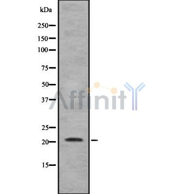 Western blot analysis of extracts from Rat lung, using TNFAIP8L1 Antibody. The lane on the left was treated with blocking peptide.