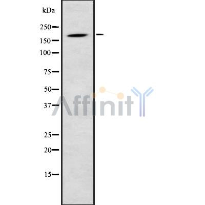 DF8853 at 1/100 staining Human gastric tissue by IHC-P. The sample was formaldehyde fixed and a heat mediated antigen retrieval step in citrate buffer was performed. The sample was then blocked and incubated with the antibody for 1.5 hours at 22¡ãC. An HRP conjugated goat anti-rabbit antibody was used as the secondary