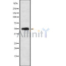 Western blot analysis IP6K1 using K562 whole cell lysates