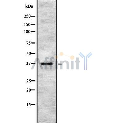 DF8858 at 1/100 staining Human breast cancer tissue by IHC-P. The sample was formaldehyde fixed and a heat mediated antigen retrieval step in citrate buffer was performed. The sample was then blocked and incubated with the antibody for 1.5 hours at 22¡ãC. An HRP conjugated goat anti-rabbit antibody was used as the secondary