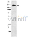 Western blot analysis of ALPK3 using K562 whole cell lysates