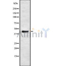 Western blot analysis of PSKH2 using Jurkat whole cell lysates