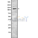 DF8866 at 1/100 staining Rat heart tissue by IHC-P. The sample was formaldehyde fixed and a heat mediated antigen retrieval step in citrate buffer was performed. The sample was then blocked and incubated with the antibody for 1.5 hours at 22¡ãC. An HRP conjugated goat anti-rabbit antibody was used as the secondary