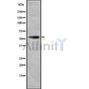 Western blot analysis of extracts from various samples, using CS061 Antibody.
 Lane 1: Mouse brain treated with blocking peptide;
 Lane 2: Mouse brain;
 Lane 3: Rat lung;
 Lane 4: Hela;
 Lane 5: B16F10.