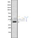 Western blot analysis of ZMAT3 using COLO205 whole cell lysates