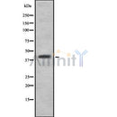 Western blot analysis of CBX8 using A549 whole cell lysates