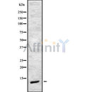 DF8875 at 1/100 staining Mouse pancreas tissue by IHC-P. The sample was formaldehyde fixed and a heat mediated antigen retrieval step in citrate buffer was performed. The sample was then blocked and incubated with the antibody for 1.5 hours at 22¡ãC. An HRP conjugated goat anti-rabbit antibody was used as the secondary