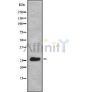 Western blot analysis of KCIP1 using COLO205 whole cell lysates