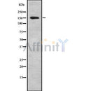 Western blot analysis IBTK using Jurkat whole cell lysates