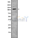 Western blot analysis of MKL2 using HuvEc whole cell lysates