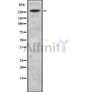 Western blot analysis of WBP7 using HuvEc whole cell lysates