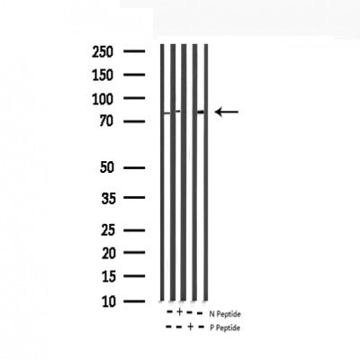 AF3062 staining Hela by IF/ICC. The sample were fixed with PFA and permeabilized in 0.1% Triton X-100,then blocked in 10% serum for 45 minutes at 25¡ãC. The primary antibody was diluted at 1/200 and incubated with the sample for 1 hour at 37¡ãC. An  Alexa Fluor 594 conjugated goat anti-rabbit IgG (H+L) Ab, diluted at 1/600, was used as the secondary antibod