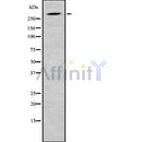 Western blot analysis SRRM2 using HuvEc whole cell lysates