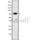 Western blot analysis of extracts from various samples, using RNF6 Antibody.
 Lane 1: hela treated with blocking peptide.
 Lane 2: Hela;
 Lane 3: Hepg2;
 