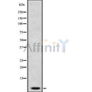 Western blot analysis of PKIG using COLO205 whole cell lysates