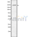 Western blot analysis of WNK2 using Jurkat whole cell lysates