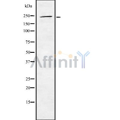Western blot analysis of WNK2 using Jurkat whole cell lysates