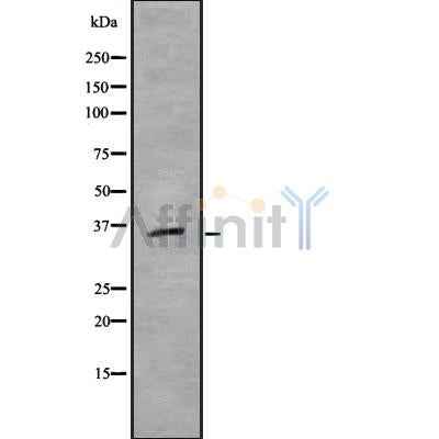 DF8895 at 1/100 staining Mouse liver tissue by IHC-P. The sample was formaldehyde fixed and a heat mediated antigen retrieval step in citrate buffer was performed. The sample was then blocked and incubated with the antibody for 1.5 hours at 22¡ãC. An HRP conjugated goat anti-rabbit antibody was used as the secondary