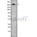 Western blot analysis NCOR2 using NIH-3T3 whole cell lysates
