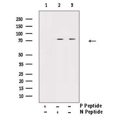 AF3063 staining Hela by IF/ICC. The sample were fixed with PFA and permeabilized in 0.1% Triton X-100,then blocked in 10% serum for 45 minutes at 25¡ãC. The primary antibody was diluted at 1/200 and incubated with the sample for 1 hour at 37¡ãC. An  Alexa Fluor 594 conjugated goat anti-rabbit IgG (H+L) Ab, diluted at 1/600, was used as the secondary antibod