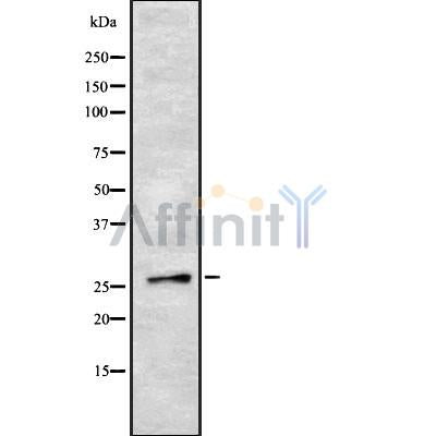 Western blot analysis SOX21 using HepG2 whole cell lysates