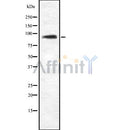 Western blot analysis of ZHX2 using Jurkat whole cell lysates