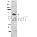 Western blot analysis of extracts from hela, using Collagen IX ?2 Antibody. Lane 1 was treated with the blocking peptide.