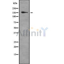 Western blot analysis of Collagen XVI ?1 using K562 whole cell lysates