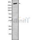 Western blot analysis of CELSR2 using MCF7 whole cell lysates