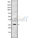 Western blot analysis of CIDEC using HeLa whole cell lysates