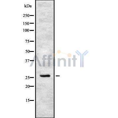 Western blot analysis of CIDEC using HeLa whole cell lysates
