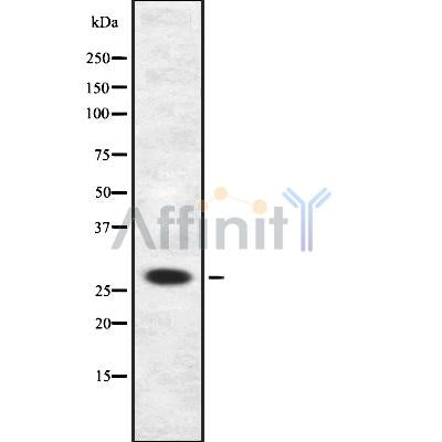 Western blot analysis of CISH using Jurkat whole cell lysates