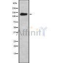 DF8917 at 1/100 staining Human prostate tissue by IHC-P. The sample was formaldehyde fixed and a heat mediated antigen retrieval step in citrate buffer was performed. The sample was then blocked and incubated with the antibody for 1.5 hours at 22¡ãC. An HRP conjugated goat anti-rabbit antibody was used as the secondary
