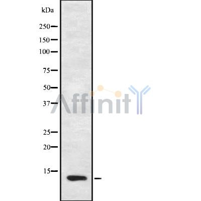 DF8918 at 1/100 staining Rat lung tissue by IHC-P. The sample was formaldehyde fixed and a heat mediated antigen retrieval step in citrate buffer was performed. The sample was then blocked and incubated with the antibody for 1.5 hours at 22¡ãC. An HRP conjugated goat anti-rabbit antibody was used as the secondary