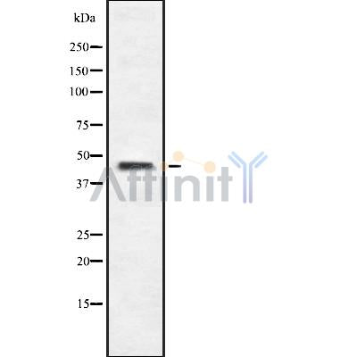 DF8919 at 1/100 staining Rat colon tissue by IHC-P. The sample was formaldehyde fixed and a heat mediated antigen retrieval step in citrate buffer was performed. The sample was then blocked and incubated with the antibody for 1.5 hours at 22¡ãC. An HRP conjugated goat anti-rabbit antibody was used as the secondary