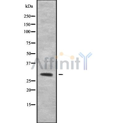 Western blot analysis of Cytochrome c Oxidase 3 using Jurkat whole cell lysates