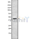 DF8922 at 1/100 staining Rat heart tissue by IHC-P. The sample was formaldehyde fixed and a heat mediated antigen retrieval step in citrate buffer was performed. The sample was then blocked and incubated with the antibody for 1.5 hours at 22¡ãC. An HRP conjugated goat anti-rabbit antibody was used as the secondary