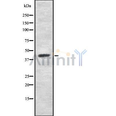DF8922 at 1/100 staining Rat heart tissue by IHC-P. The sample was formaldehyde fixed and a heat mediated antigen retrieval step in citrate buffer was performed. The sample was then blocked and incubated with the antibody for 1.5 hours at 22¡ãC. An HRP conjugated goat anti-rabbit antibody was used as the secondary