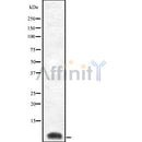 Western blot analysis of Cytochrome c Oxidase 8C using Jurkat whole cell lysates