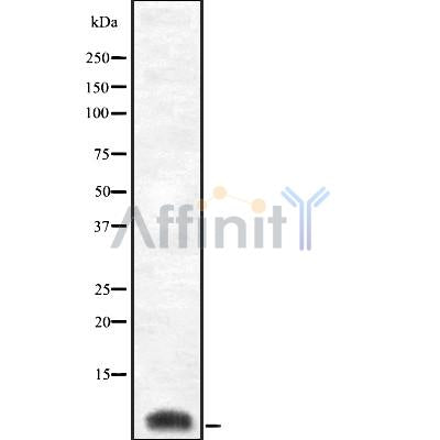 Western blot analysis of Cytochrome c Oxidase 8C using Jurkat whole cell lysates